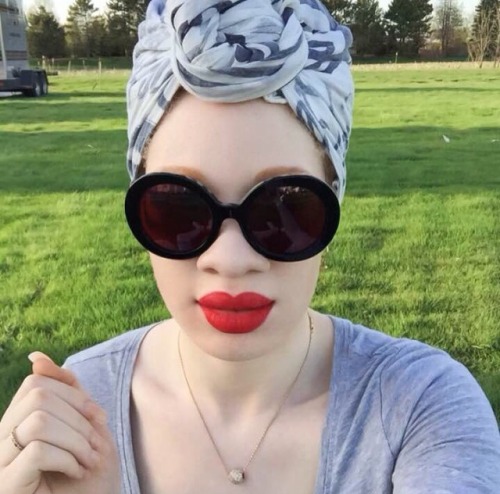 invisiblemelanin:Black people with albinism are strong and beautiful, don’t deny our heritage.