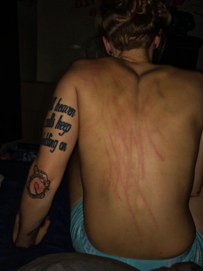 My boyfriend has scratches on his back