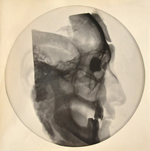 dame-de-pique:Radiographie, vers 1930