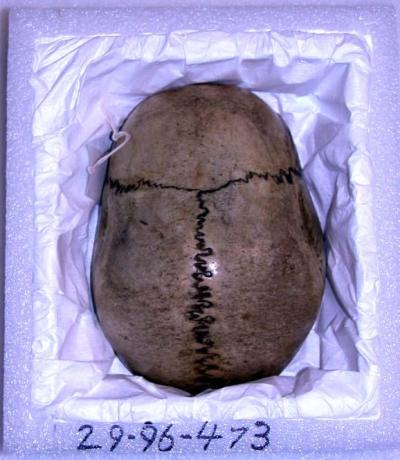 centuriespast:
“Skull Bowl
Buddhist, Japan
Materials: Skull Bone.
Bequest of Maxwell Sommerville, 1904
Penn Museum
”