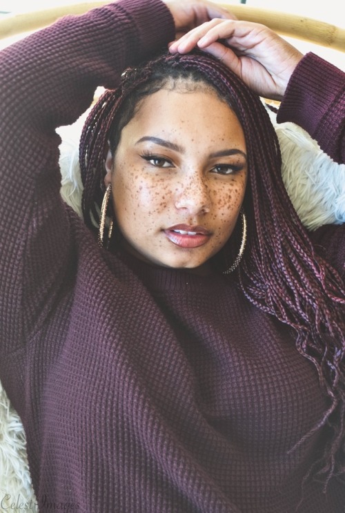 bigwymen:  delamind:  ‘Speckled’ w/ Cherie ✨ Model ig: junqlecat Photographer IG: celestamemoir Celestimages.com  Love the freckles..beautiful