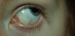 utensylia:  my eye looks awesome 