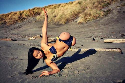 disabledpeoplearesexy:  Kanya Sesser  going through and reblogging some of my favourite old posts