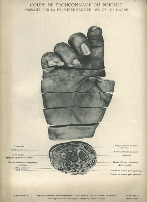 corporisfabrica: An early effort at plasticisation as a technique for preserving the morphology of d