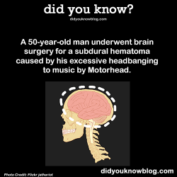 did-you-kno:  A 50 year old man underwent