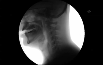 sagansense:X-ray gifs of people doing ordinary and extraordinary things By Lauren Davis | io9 | Imag