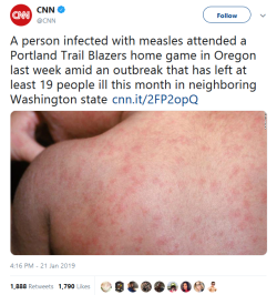 its-only-dogs-and-memes: toopunktofuck:  rubyredrose1207:  kari-izumi:  viostormcaller:  blueinkblot:   gahdamnpunk: VACCINATE YA KIDS FFS The other thing about measles is that it resets your body’s memory of other diseases. So all those times you’ve