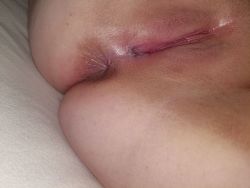 rotten-littlegirl:  A naughty ass and a tender pussy waiting to be used and filled