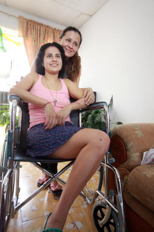  Yady Fernández Columbian soccer player who lost her left leg.