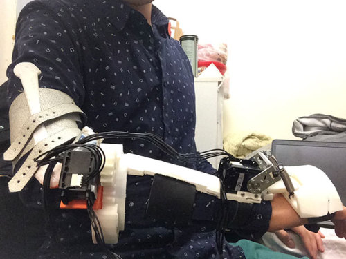 Exoskeleton Could Quell the Tremors of Parkinson&rsquo;s Disease Patients at Crucial Moments&nbs