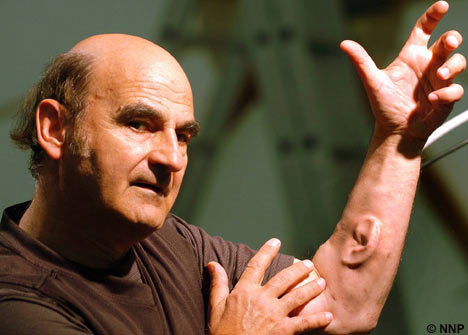 sixpenceee:  Artist Gets an Extra Ear Implanted Into His ArmAustralian performance artist Stelios Arcadiou, known as Stelarc, had the third ear created from cells in a lab in 2006. The ear is made of human cartilage. Stelarc, who is visiting professor