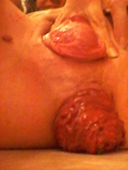 zenbizarre:  musclegap2015:  My double prolapse. Pussy and asshole.   Like extreme pics? You’ll lilkehttp://zenbizarre.tumblr.com/Pumping, Electro, Sounding, CBT, and other kinky stuff 