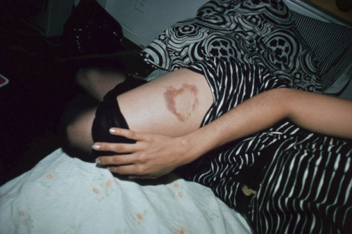 secretcinema1: Heart-Shaped Bruise, New York, 1980, Nan Goldin