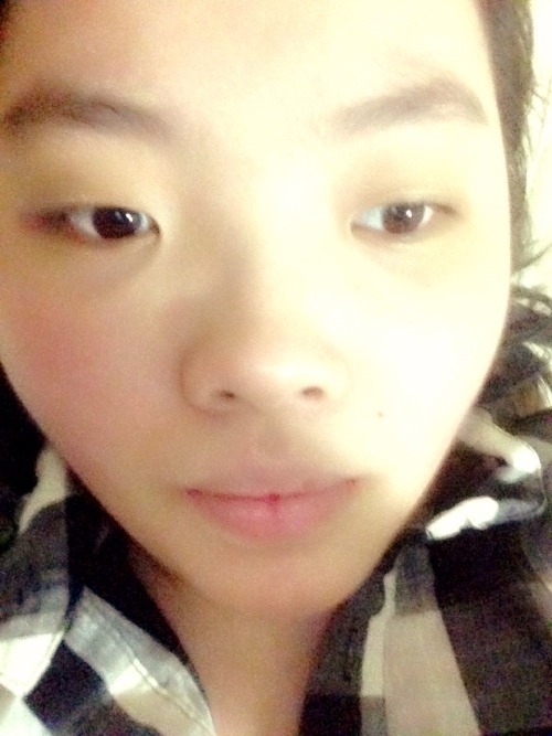 sophaldred:My name is Angie. I’m a 20 year old bed bound woman with a spinal injury, facing imminent