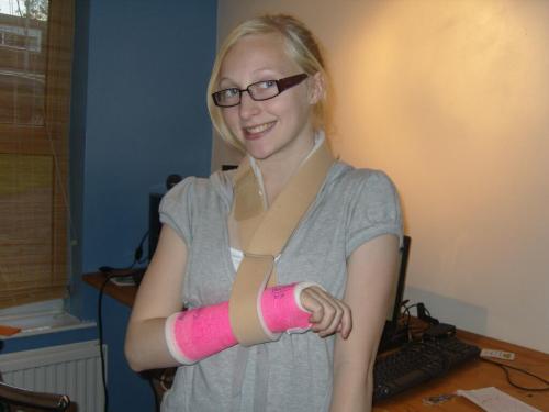 Looking good in her specs and short arm cast