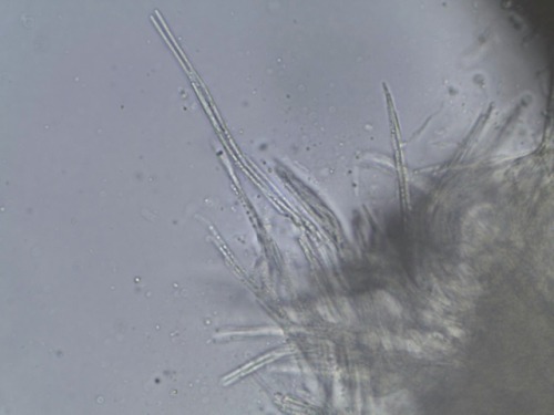 Grass choke disease (Epichloë typhina -fungus) symptoms on its poacean host.
