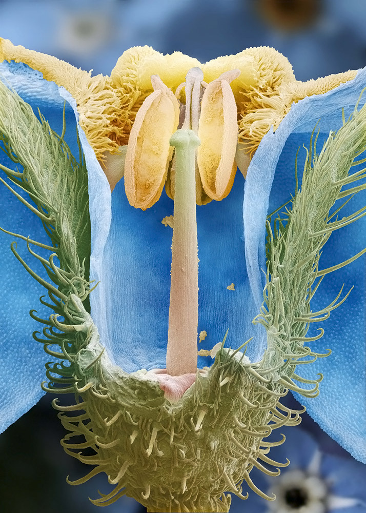 Scanning electron micrograph, false colored, of the parts of a flower.
Peduncle: The stalk of a flower.
Receptacle: The part of a flower stalk where the parts of the flower are attached.
Sepal: The outer parts of the flower (often green and...