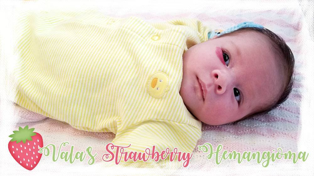 Update on our baby girl’s Strawberry Hemangioma on the blog. See profile info for the link. Thanks for everyone’s love, support, and prayers. Our girl is a good sport and a strong baby. ❤🍓
http://ellababybump.blogspot.com
#StrawberryHemangioma...