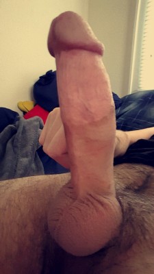 gomcodude-the-third:  There was a lot of foreskin pulled through by Circdoc here.  Thankfully the kiss of the Gomco was able to transform it.