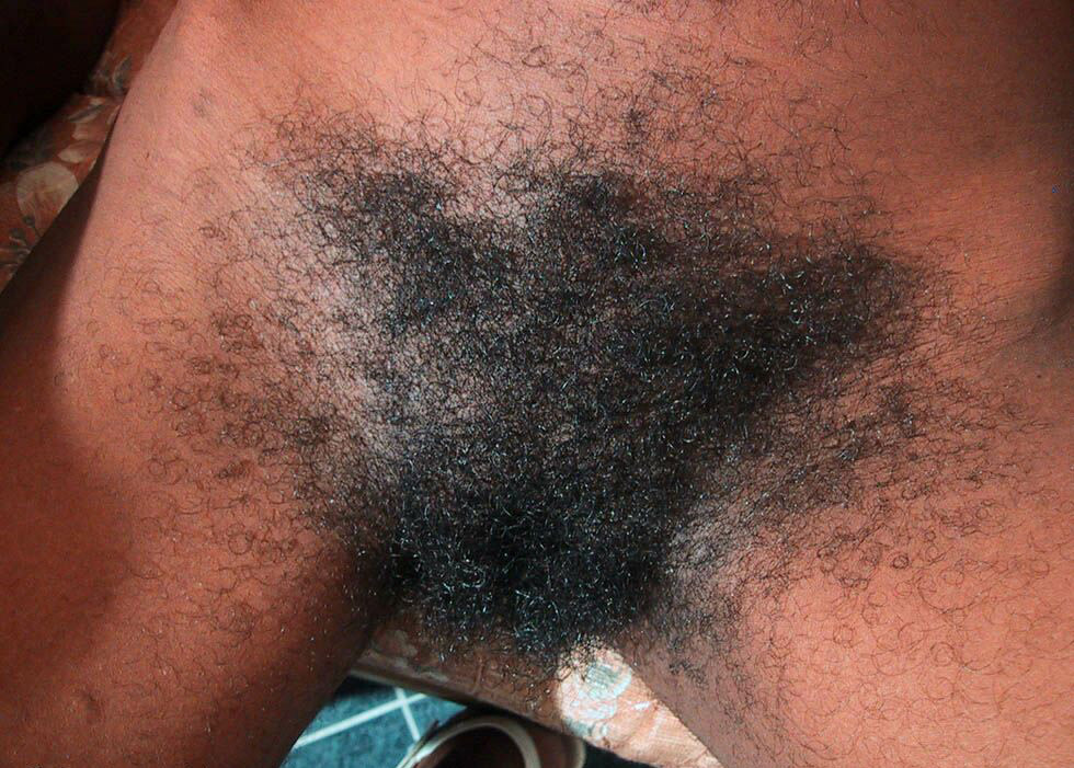 superhirsuteandbushychicks:  Here we present Manuela with her really huge bush. OMG.