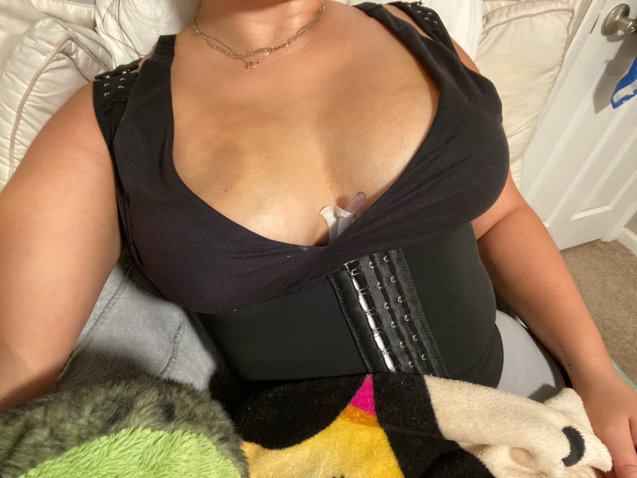 Porn Pics yitties swollen after lipo & fat transfer