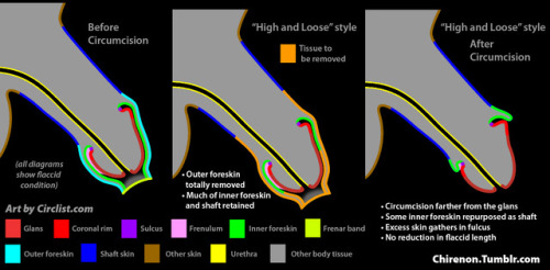 snippykins: circcity-bareheadnation: jzeqm23: tightlycut: ourmalcirc: chirenon: Four Circumcision Ty