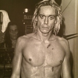 icky-pop:  Iggy Pop stitched up after falling