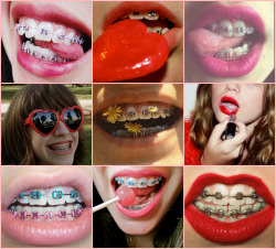 nymphetfashion:  Nymphets with braces 