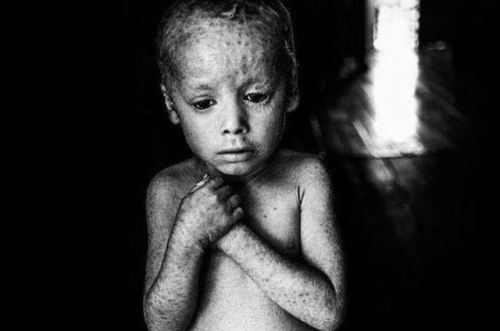 heliobeltranio:    Em ensaio e documentário, fotógrafo argentino PABLO PIOVANO revela ‘o custo humano dos agrotóxicos’.  