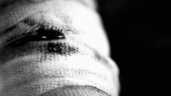 actividadsuicida:  Malditas cicatrices, sangraban todo el tiempo, su piel también
