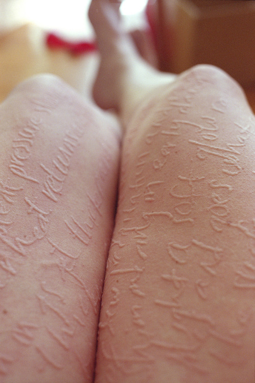 huffingtonpost:  Brooklyn-based artist Ariana Page Russell grew up struggling with a skin condition that extended beyond wavering self-esteem. Russell has dermatographic urticaria, also known as “skin writing.” Simply defined, the condition inflames