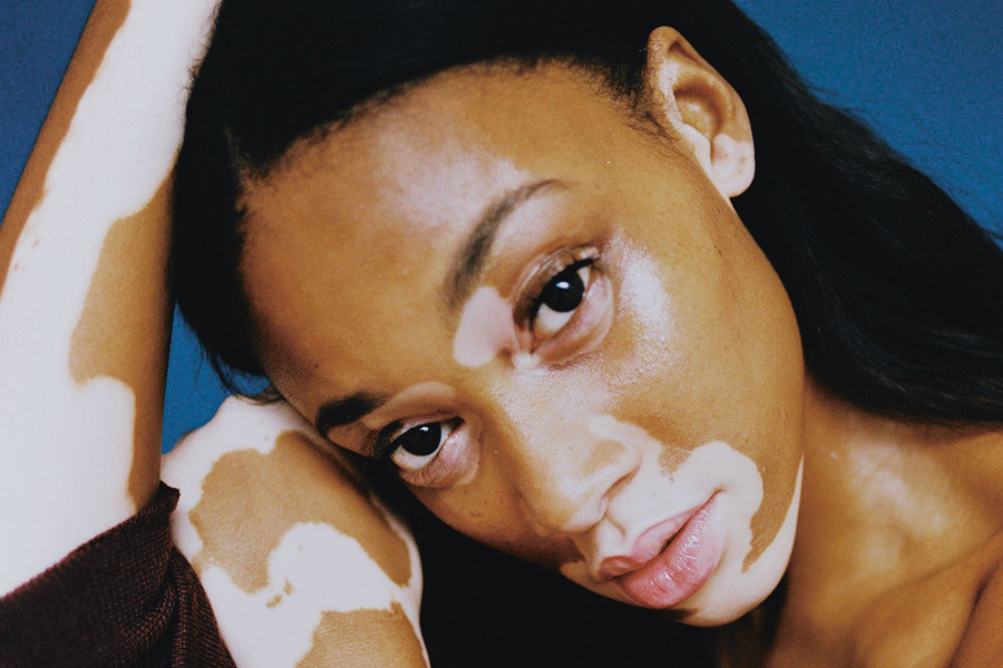 eps-ilon:  chantelle winnie by harry carr for i-d magazine