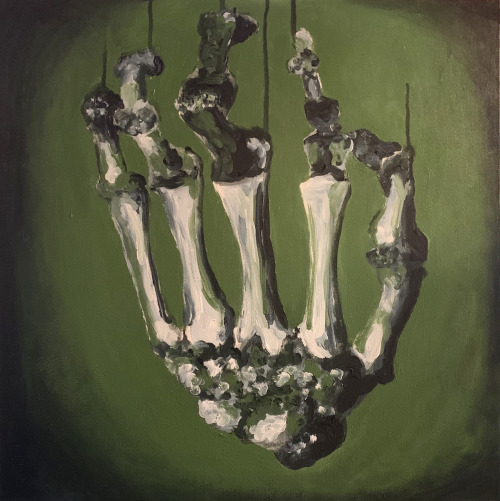 Atrophy, acrylic on canvas, 20 x 20″, 2019source: “typical atrophy of the phalanges in l