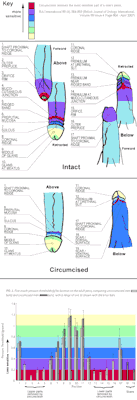 eternalii-famishiis:  circumcisedperfection:  uncutting:  It’s worth pointing out that circumcision is a varied procedure, which can remove differing amounts of skin from different people. But the fact remains that highly sensitive tissue is always