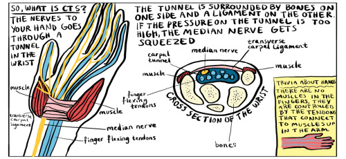 skelettflickan: Some information I gathered while having carpal tunnel syndrome myself! I got it alm