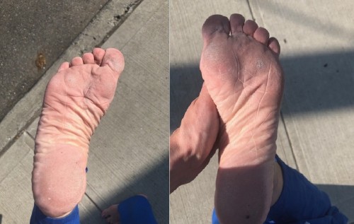 Dirty, calloused soles