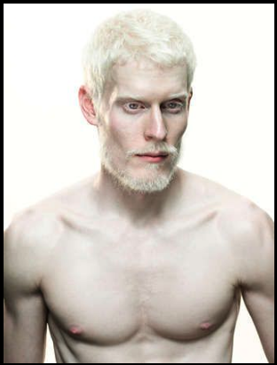 alanspazzaliartist:  Albinos looks so misterious…1.Bera Ivanishvili2. Steven Thompson3.Sanele