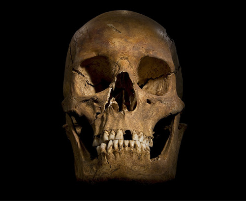 thebritishnobility:Richard III : The twisted bones that reveal a king When Richard was killed at t