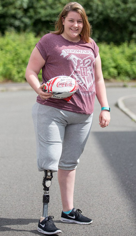 Lost her leg when a rugby injury shattered her patella, shredded ligaments and damaged an artery.