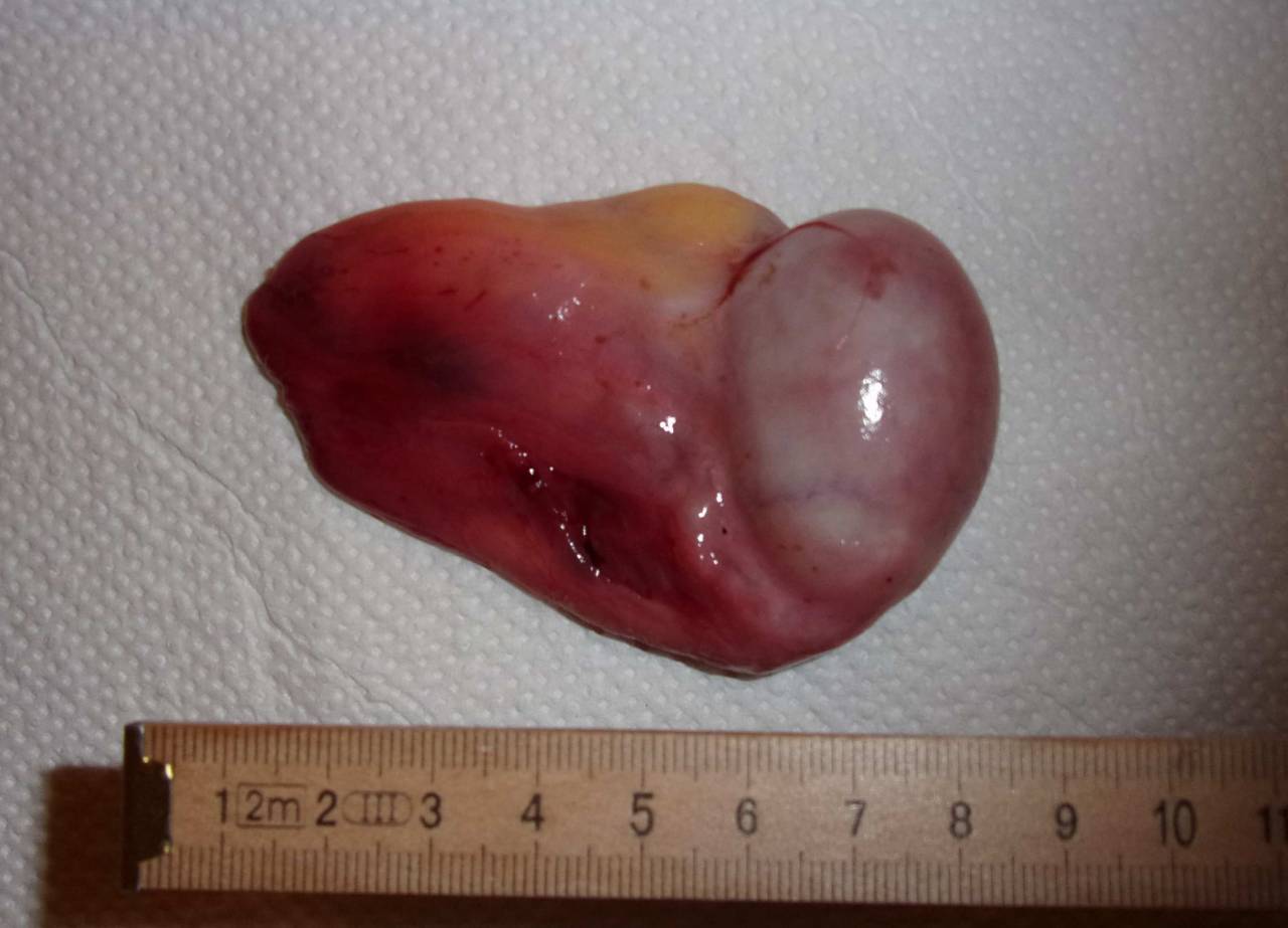 juliusmr:  testicle cut off