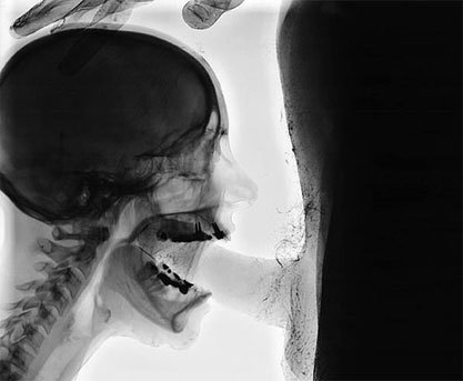 debbiedebutante:  Fun with the X-ray machine! #blowjob #seethrough #oral #sex #swingers