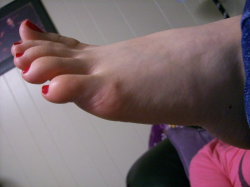 red toes