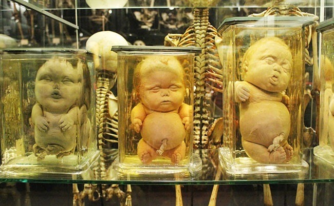 unicorn-meat-is-too-mainstream:  Museum Vrolik Museum Vrolik houses a tremendous