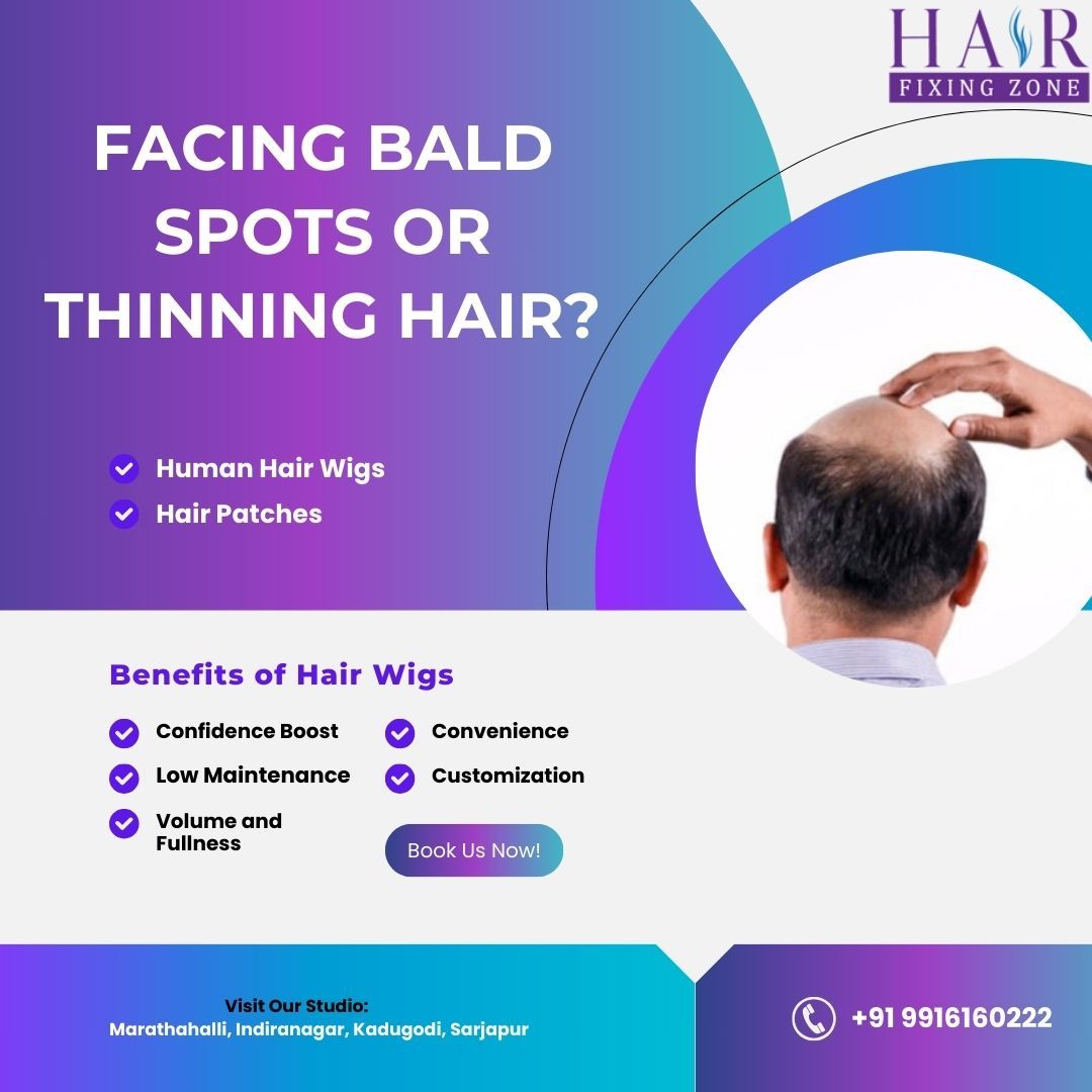 FACING BALD SPOTS OR THINNING HAIR? – @hairfixingz 