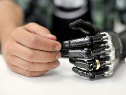 engadget: 7 real-life cyborg implants 