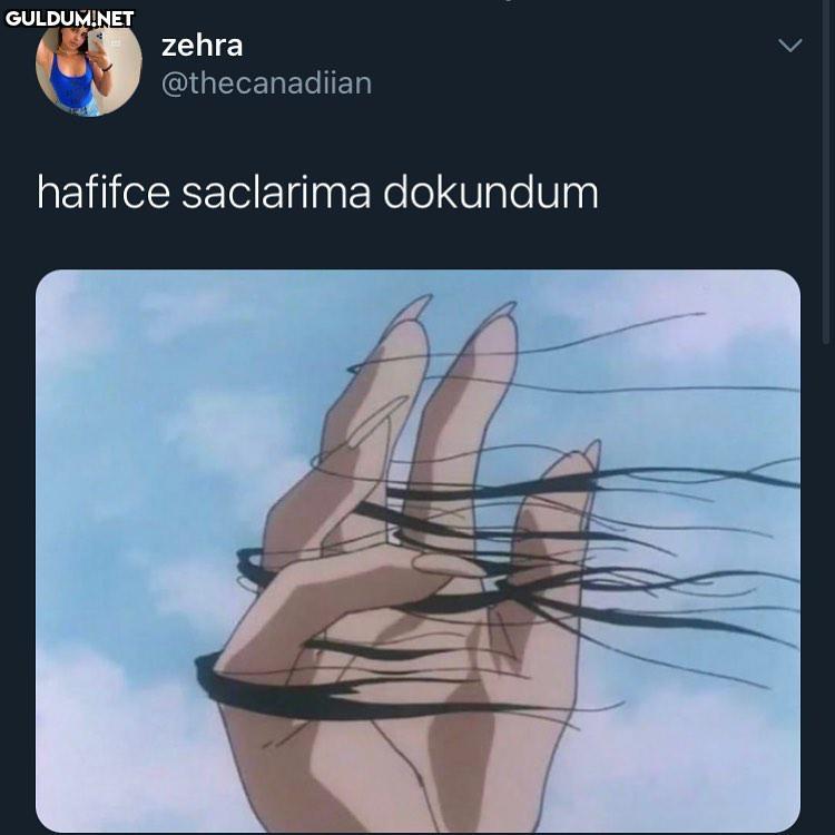 20 yaşında kel kalmaya...