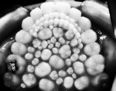 psychomindset:  Hyperdonita 