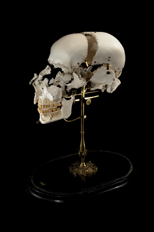 ryanmatthewcohn:Antique Exploded Skull. Ryan Matthew’s Collection. Photo by Sergio Royzen.