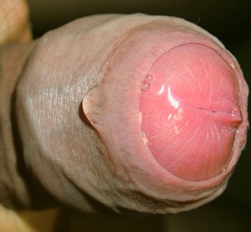 Porn Pics Circumcision required
