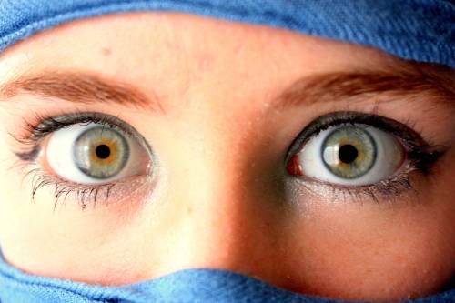 XXX sixpenceee:  Anisocoria is a condition characterized photo